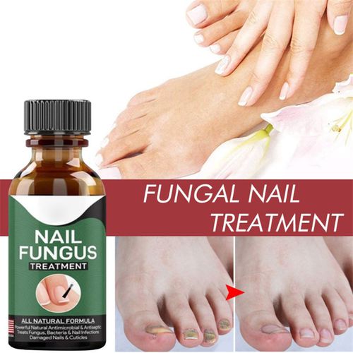 Fast Nail Fungal Treatments Nail Repair Essences Serum Care